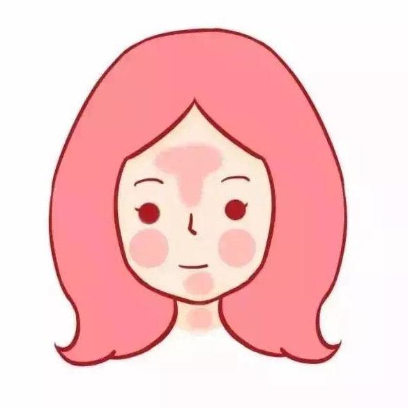 背部吸脂