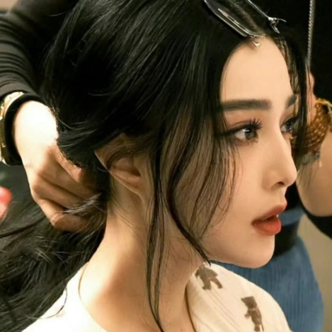 美瞳线手术